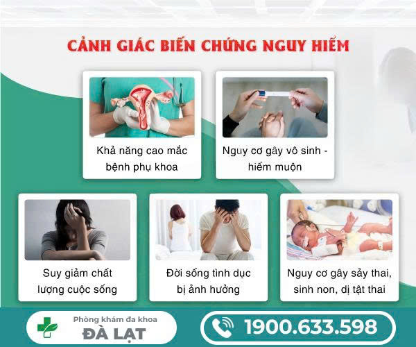 Hình ảnh minh họa